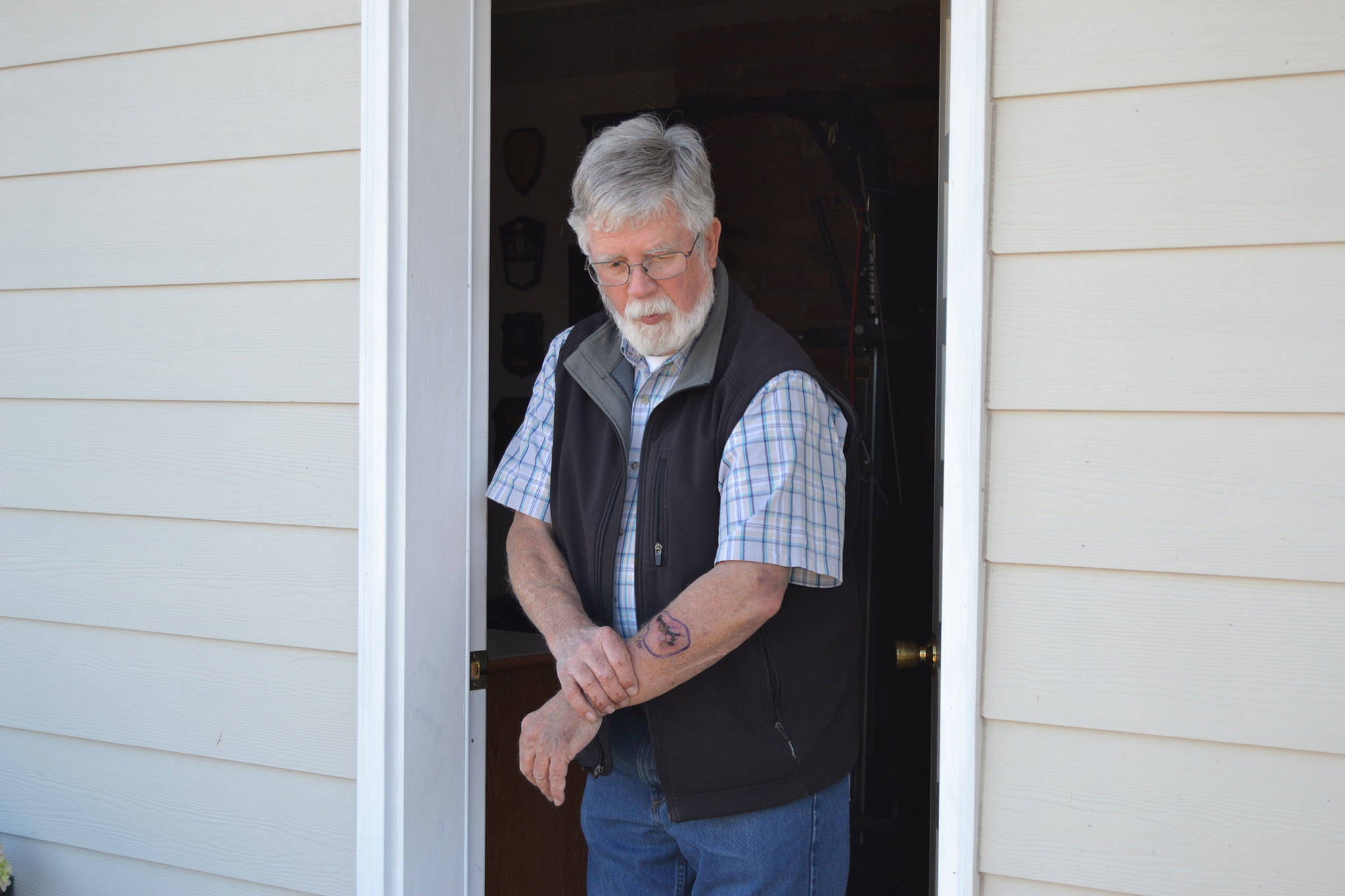 Terry Moore of Sequim stands in his home’s doorway where he was attacked by pit bulls on Sept. 23. Moore had eight stitches put in at Olympic Medical Center that night. The dogs that attacked him are in quarantine awaiting a decision on if they will be euthanized or taken from their owner by a Clallam County District Court judge. Sequim Gazette photo by Matthew Nash