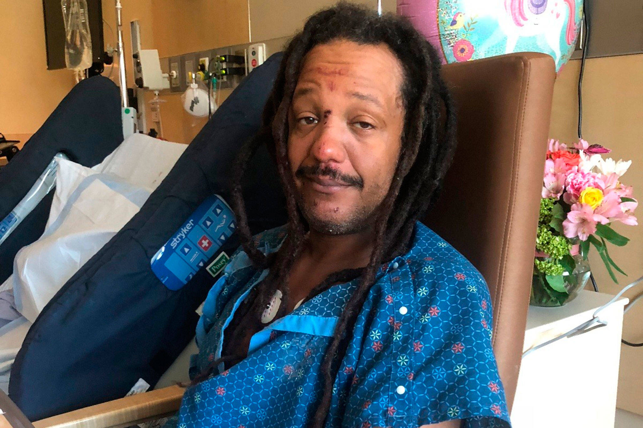 Joe Allen, Jr., of Port Angeles continues to recuperate in Wenatchee after he was struck in the back of the head with a rock at a Phish concert in the Gorge Amphitheater on July 21. Submitted photo