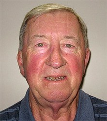 Gary Murphy