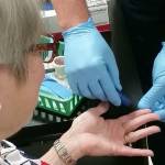 The A-B-Cs of viral hepatitis