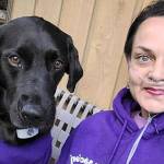 Sequim resident Melissa Smith, pictured here with Aulani, is recovering in Seattle from lungs and liver transplant surgery. Submitted photo